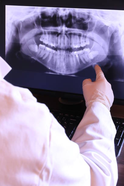 Best Emergency Dental Care for Abscessed Tooth in Frackville, PA