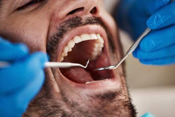Best Broken or Cracked Tooth Emergency Dentist in Frackville, PA