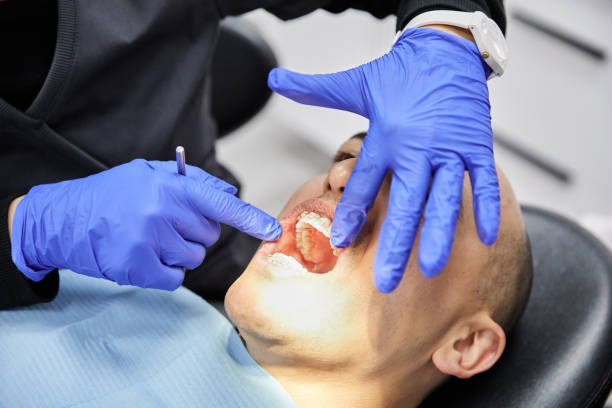 Best Emergency Dentist for Knocked-Out Tooth in Frackville, PA